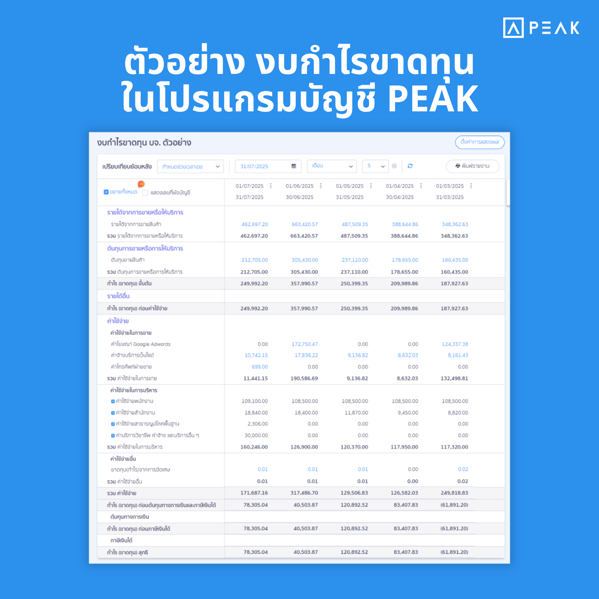 งบกำไรขาดทุน